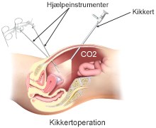 Kikkertundersoegelse_underliv.jpg