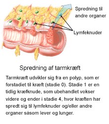 Tarmkraeft_spredning.jpg