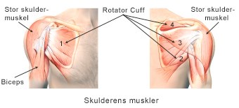 Trække ud Spole tilbage beskydning Rotator Cuff læsion – Hurtig afklaring | Aleris