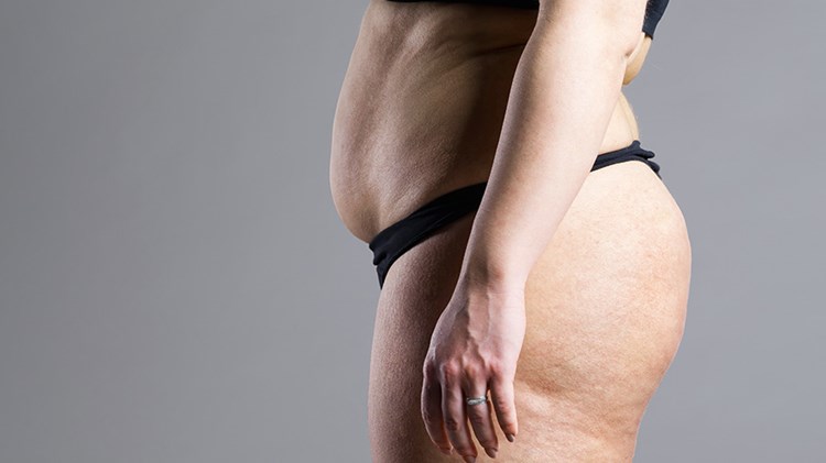flere_bliver_fedmeopereret_1200x500.jpg