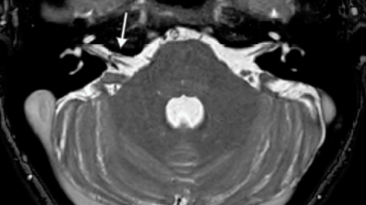 Skrivemaskinetinnitus_1200x600px.png